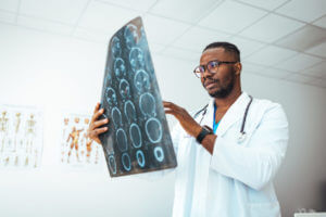 A neurologist is reviewing a medical brain scan to check for signs of Multiple Sclerosis.